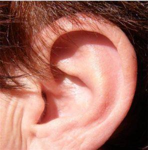 Tinnitus Without Hearing Loss