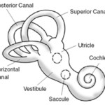 Pulsatile Tinnitus - Symptoms And Remedies For Pulsatile Tinnitus